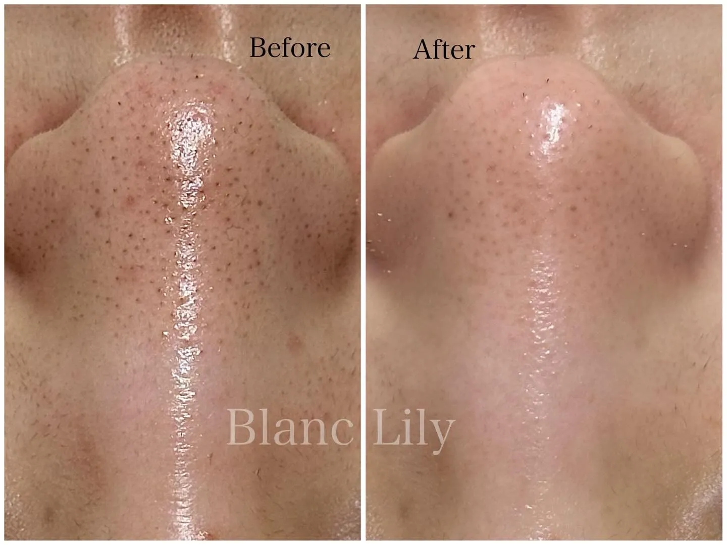 お通いいただいているお客様の一部ですが症例です💛